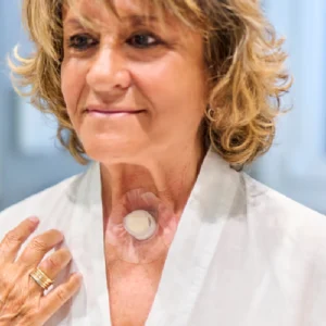 Guía post operatoria para el paciente con laringectomía total - Atos